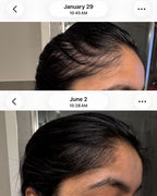 Scalp Primer